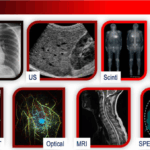 medical imaging modalities