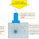 Schematic diagram of the PA signal generation, detection, and reconstruction mechanism. Different stages of producing PA signals including: (1) Optical excitation, (2) Scattering of photons and tissue illumination, (3) Absorption of photons by chromophores, (4) Thermoelastic expansion due to absorbed energy, (5) Acoustic wave propagation, (6) Detection of acoustic waves by ultrasound probe, and (7) Reconstruction of acquired signals and image generation